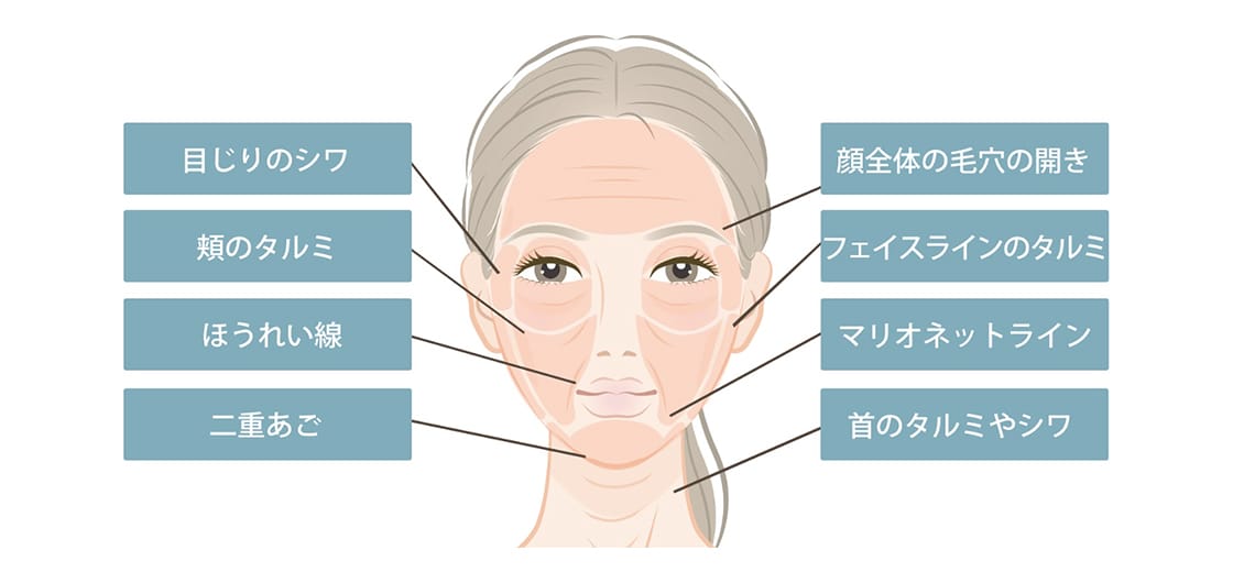 サーマクール（お顔の引き締め）| 美容整形外科のジョウクリニック