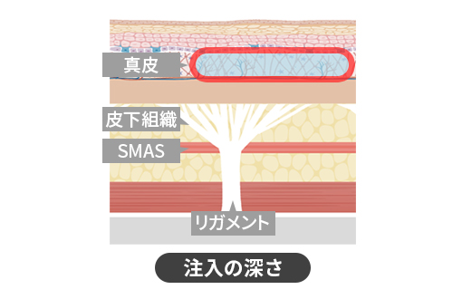 コラーゲンブースター注入 | 美容整形外科のジョウクリニック