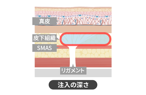 コラーゲンブースター注入 | 美容整形外科のジョウクリニック