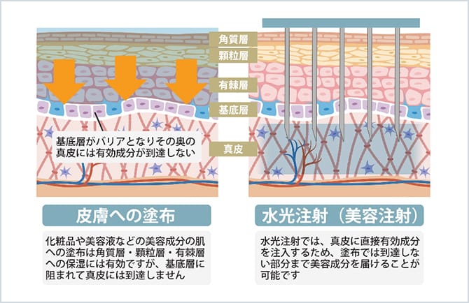 美肌注射 | 美肌注射ならジョウクリニック