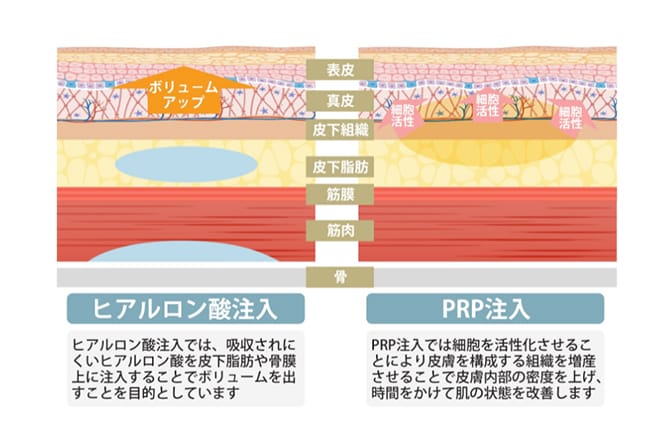 ニキビ・ニキビ痕治療 | 美容整形外科のジョウクリニック